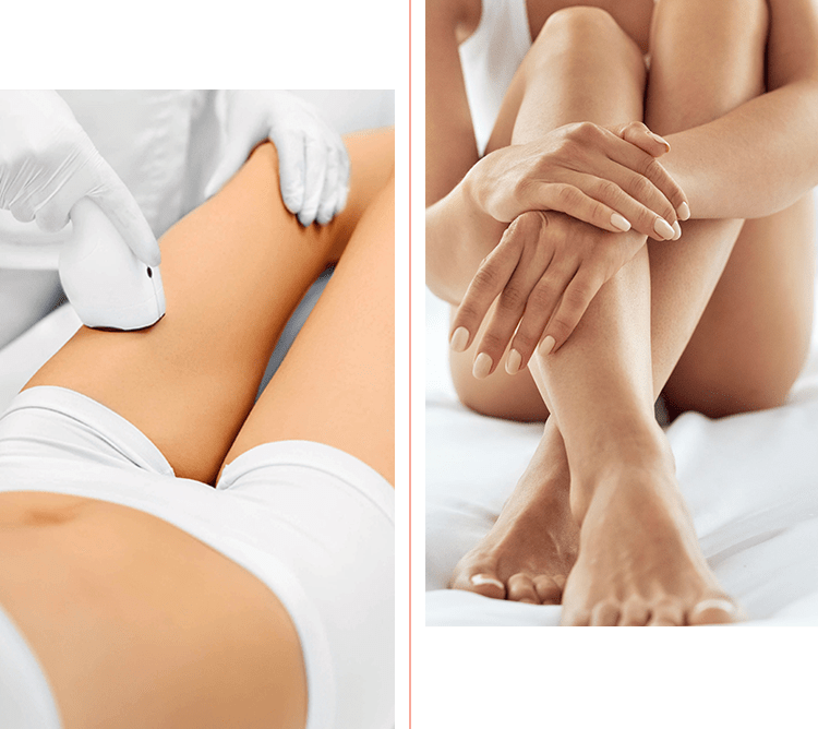 Foto-epilazione a luce pulsata progressiva definitiva Ticino